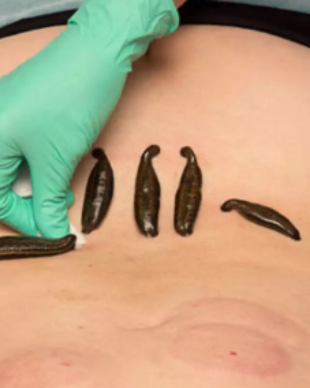 Leech